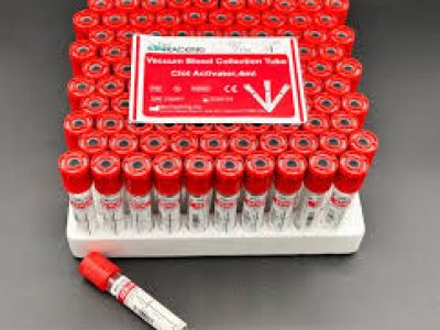 Vacutainer Red top